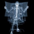 Nick Veasey